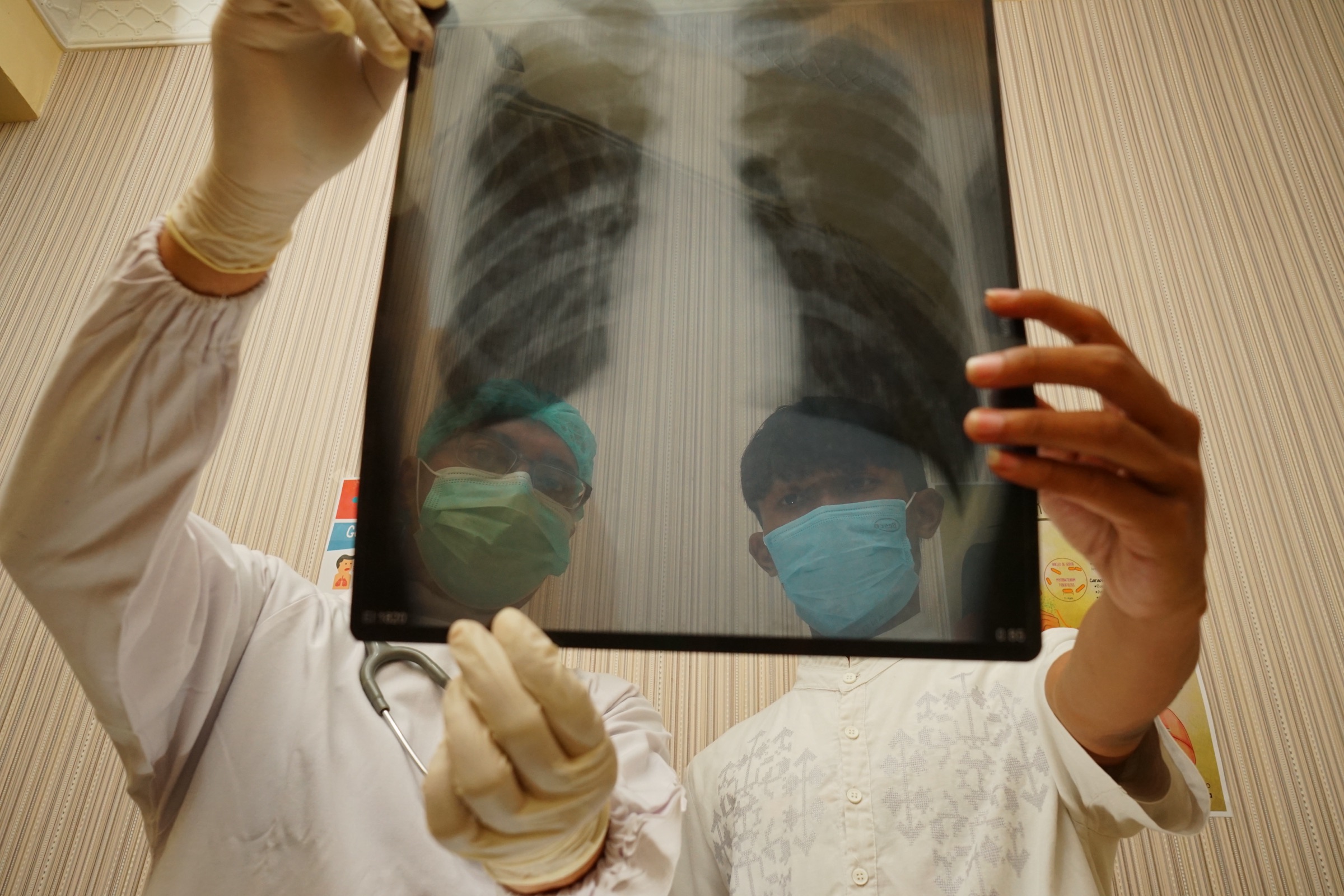 Two masked clinicians hold up a chest X-ray film against the light, studying the lungs together; the patient is not in frame.